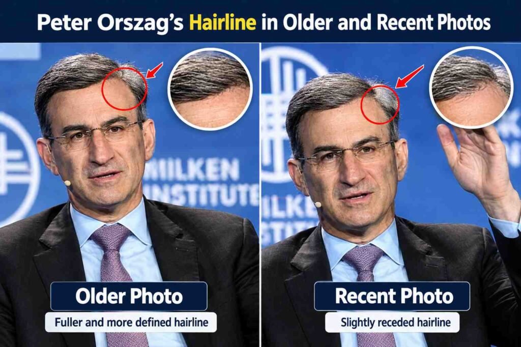 Peter Orszag Hairline in Older and Recent Photos